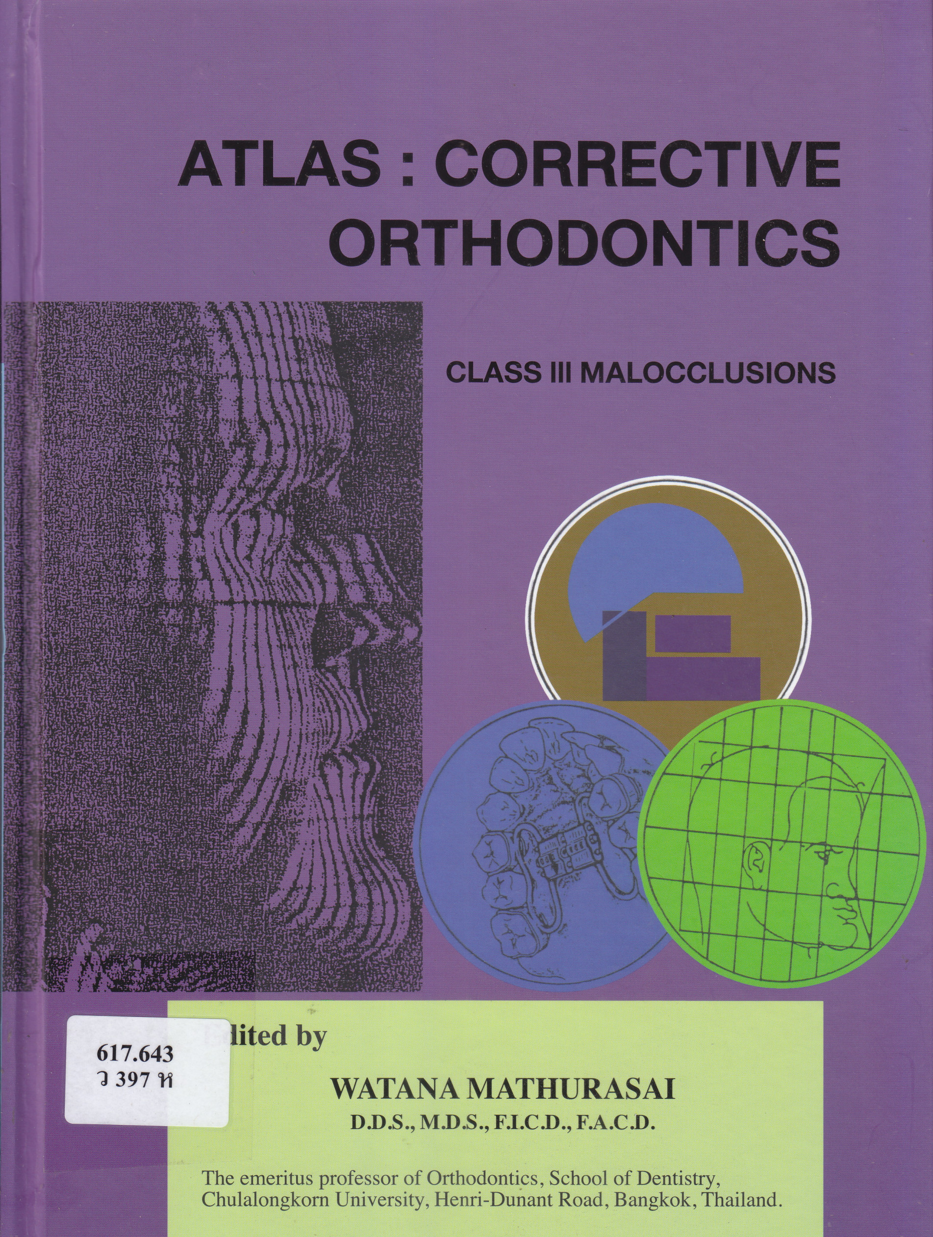 ภาพประกอบ :หนังสือประกอบภาพ : การแก้ไขทางทันตกรรมจัดฟัน ฟันซ้อนเกประเภทที่ 3.